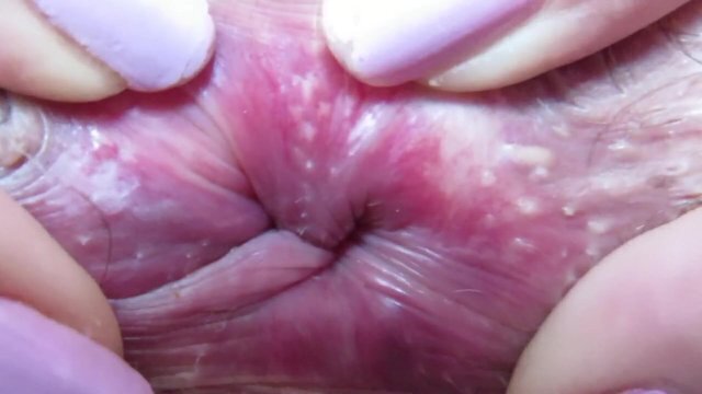 Extreme close winking asshole