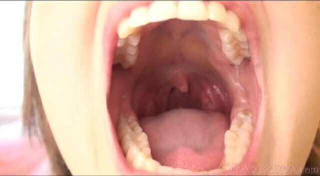 ROXY/JAYNE'S FIRST MOUTH CLIP