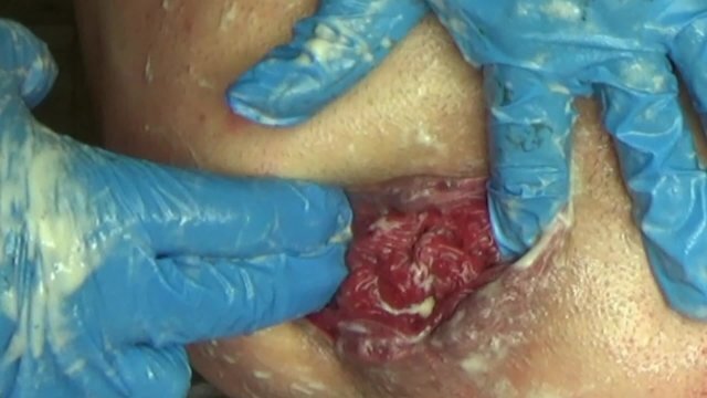 fisting Professional Full 1080p