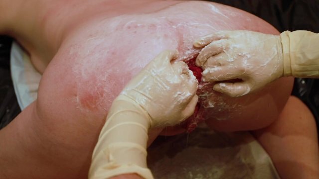 Analdehnung Rose blüht