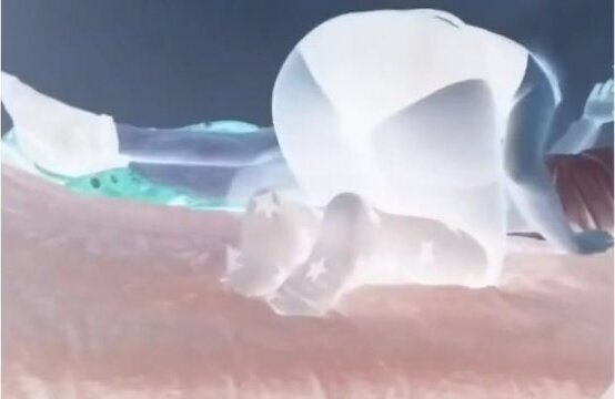 Tights holes stretched and used