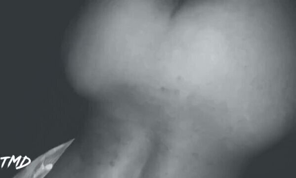 TMD: Explosive FARTS after Eating Mc Donalds!