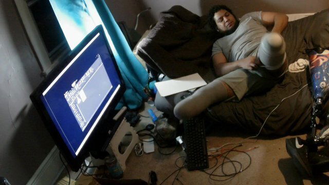 Onlyfans Request Putting Prosthetics