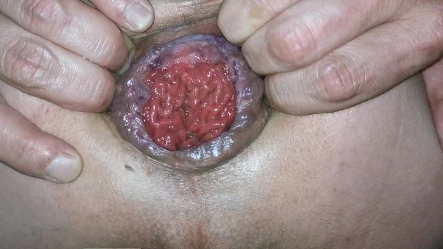 stretching pushing rosebud