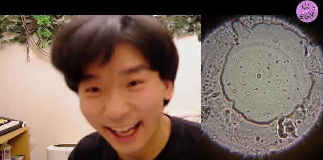 初めての精子観察