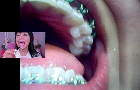 jordan, Mini cam, vore fetish, endoscope