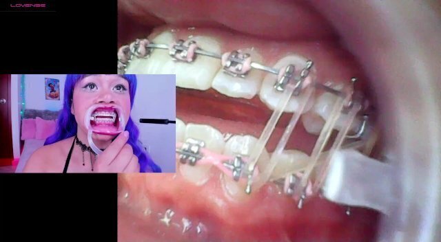 Jordan, suspenders, braces