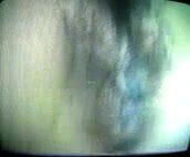 (0010)Zhangjiajing Nurses Taiwanese