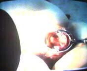 (043)Nurses Zhangjiajing Taiwanese Taiwan