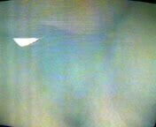 (14)HusufengNurses Taiwanese Taiwan