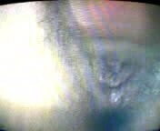 (21)HusufengNurses Taiwanese Taiwan