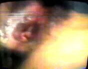 (004)HusufengNurses Taiwanese Taiwan