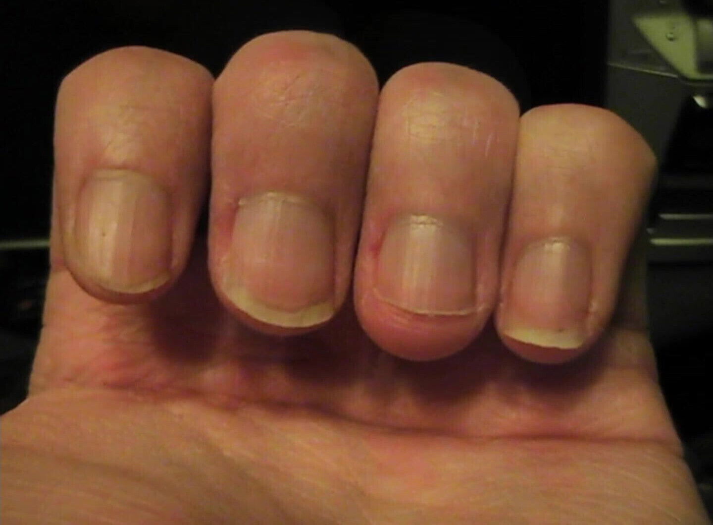 Olivier hands nails fetish pictures from 2010