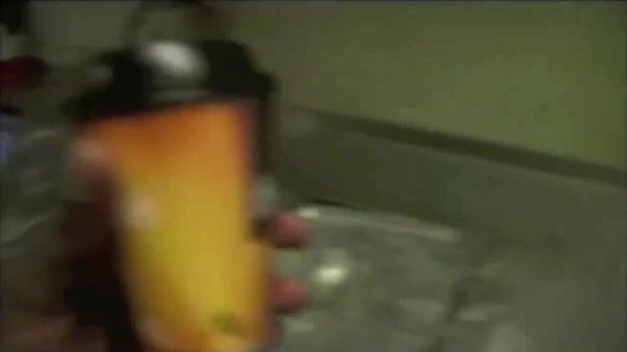 Doctors Upgrade Porn Star Lethal Lipps Fake Teeth For Better