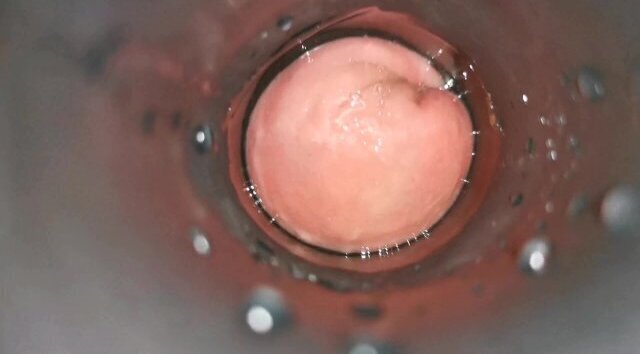 Gaping asshole rosebud with plug tunnel Hollow plug Horsengine