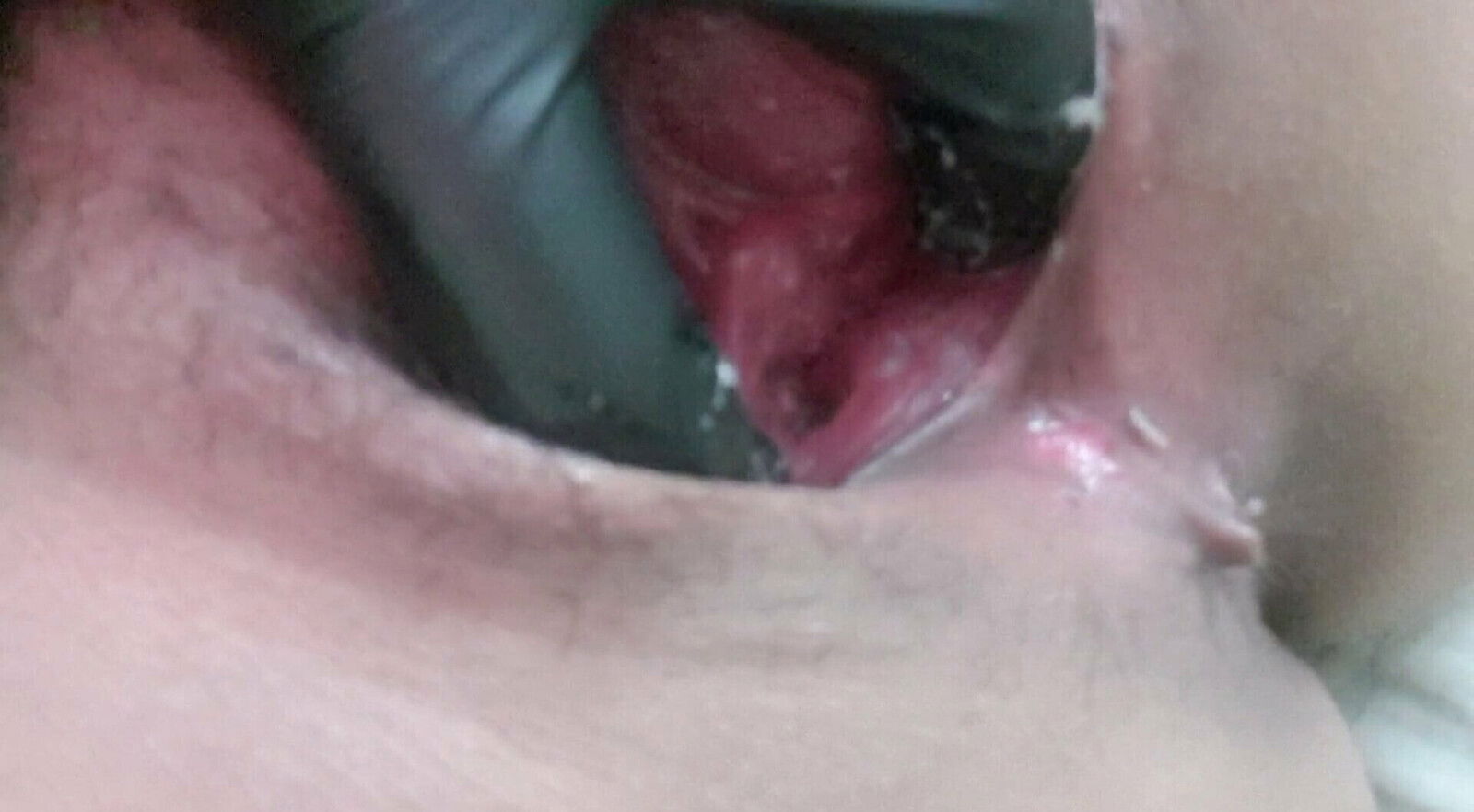 After Getting Rammed Brutally Fucked