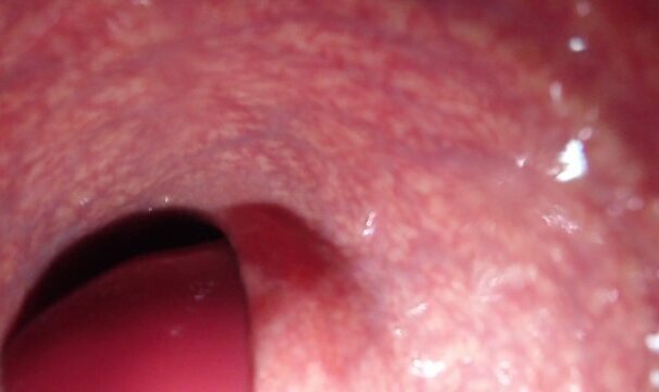 Internal View Dragon Diego Compilation-ish