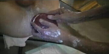 TPH's Enormous Prolapse Ring