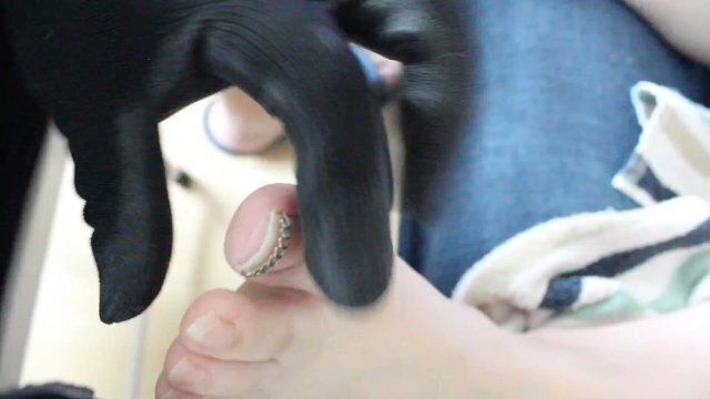 ingrown toenails cure#5 Uncensored