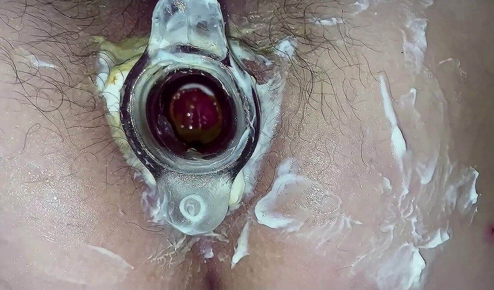gaping tunnel plug. Hairy cunt asshole close-up