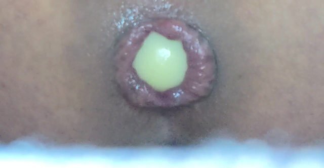 アナルに卵を入れて拡張