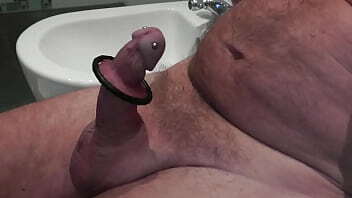 Black ring at my foreskin
