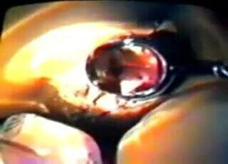 9)Zhangjiajing Nurses Maid Dildo Nurses Taiwan Taiwanese