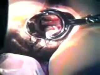 Zhangjiajing Nurses Maid Dildo Taiwan Taiwanese(001