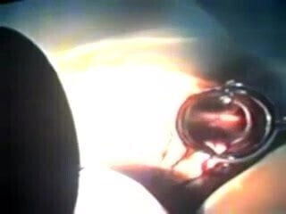 Zhangjiajing Nurses Taiwan Taiwanese Nurses Maid Dildo(3