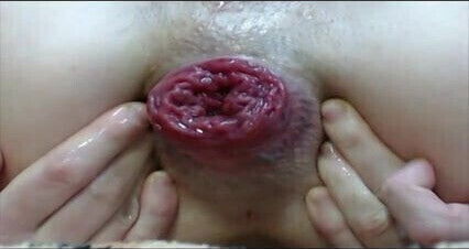 BEST ALL:PROLAPSE,FIST