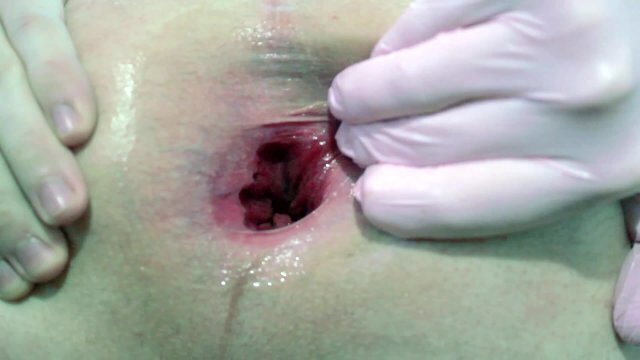 Trying self fisting, gape.