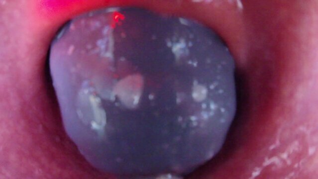 Internal Camera Dragon Flint Fucks Fills Condom Deep Ass, Heartbeat