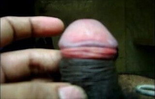 Rolling forward foreskin