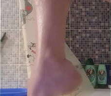 Burning bitch smears cream legs bathroom