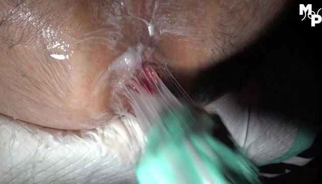 Heute wird Arschfotze geweitet