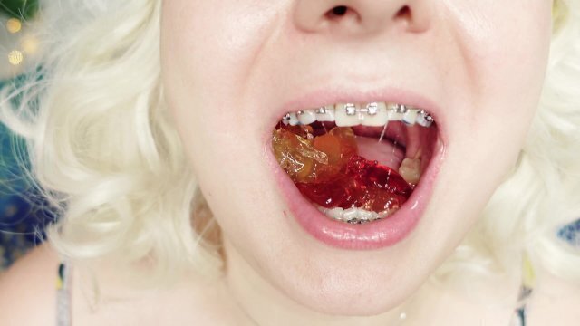 braces fetish: close video mukbang jelly candy