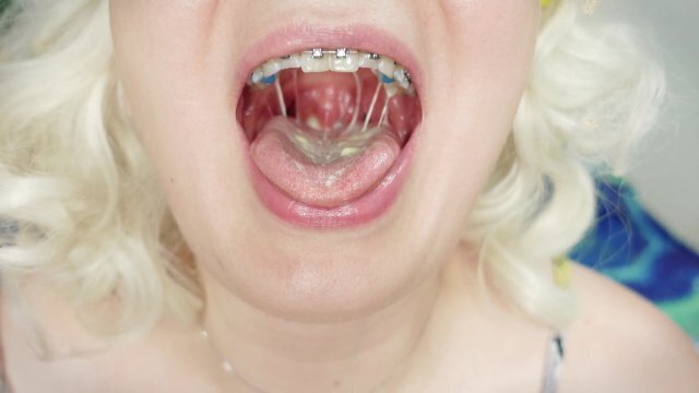 braces fetish: close video mukbang tasty ice-cream