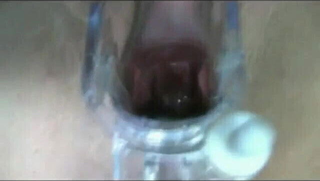 Candi from Texas- speculum