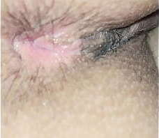 Cuzinho rosa piscando