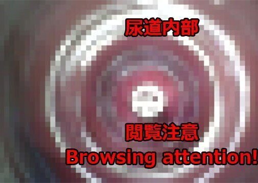 【閲覧注意】内視鏡で尿道オナニー。挿入中に潮吹きして、抜いた瞬間に水が吹き出す様子です。Urethral masturbation with endoscope.