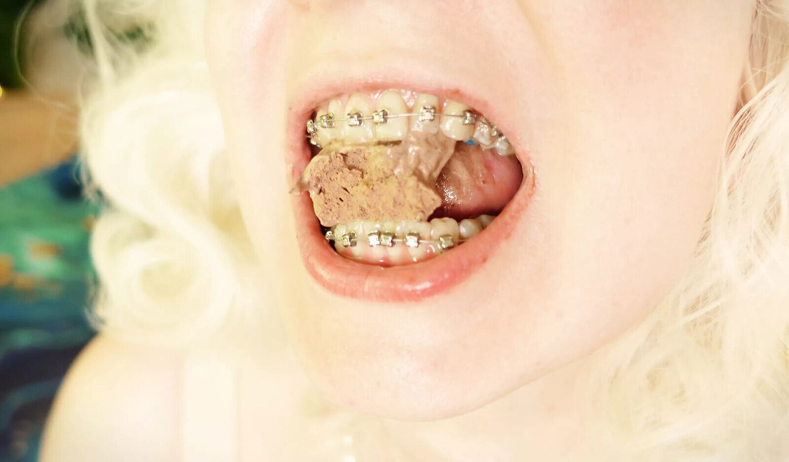 BRACES fetish ASMR video eating food MUKBANG...