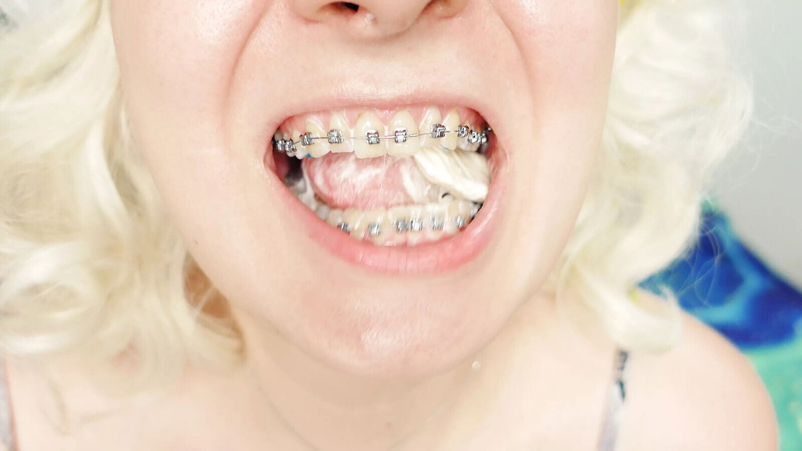 braces fetish: close video mukbang