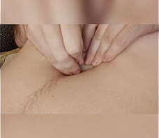 Dilataci&oacute_n de ombligo