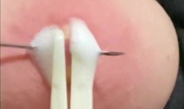 Bdsm painful breast torture nipple piercing needleplay