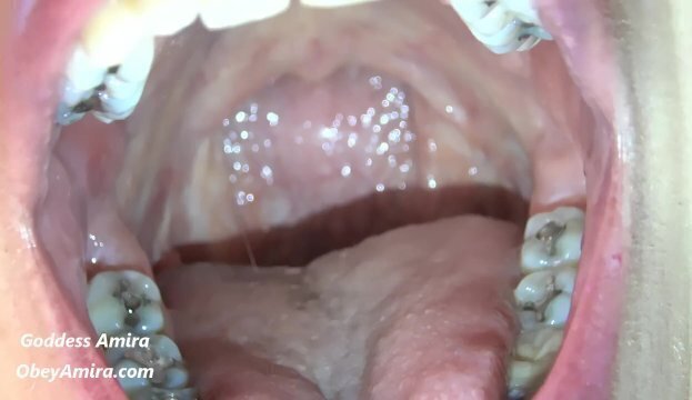 Dancing Uvula