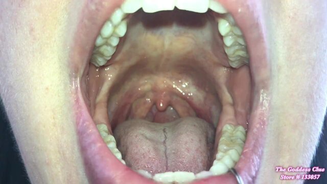 Mouth Open Wide Part