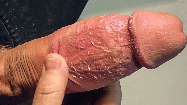 смегма крайней плотью большом толстом члене дрочит кончает, грязный член