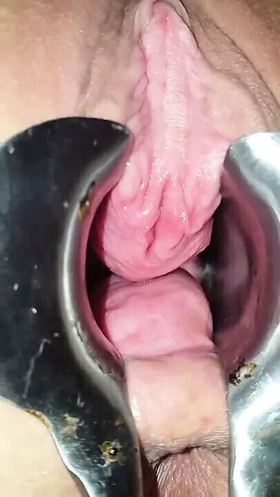 Peehole play