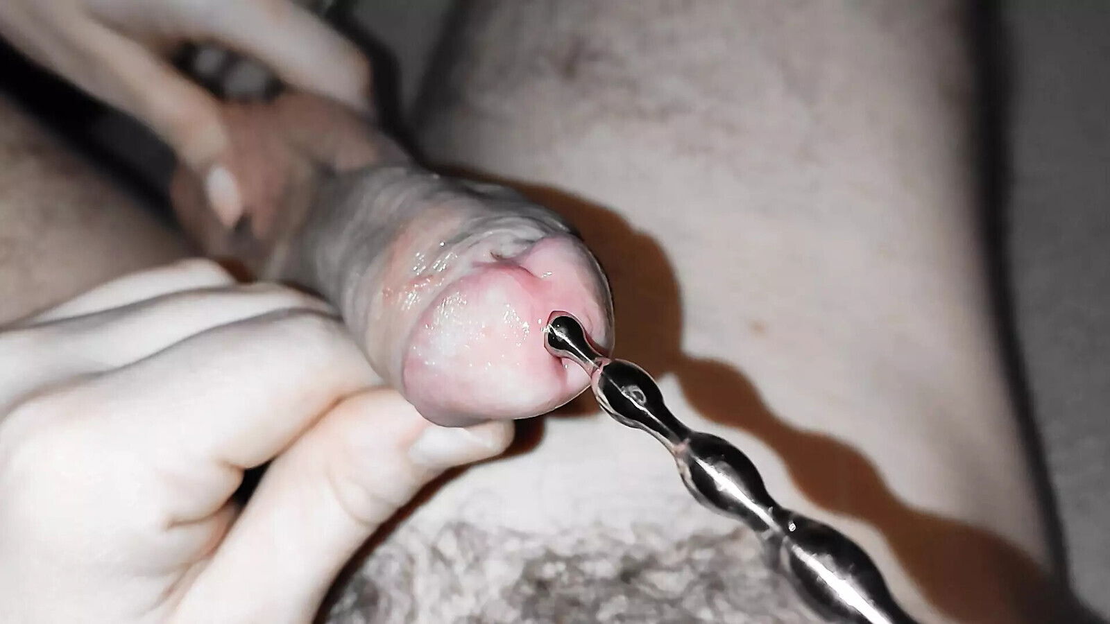 Dilator hard pain action