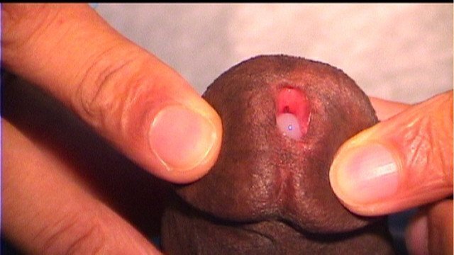 Sperm hole close with electric toothbrush